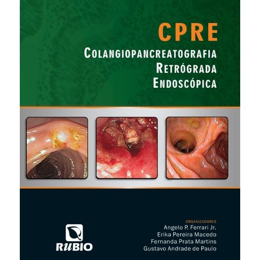 cpre-colangiopancreatografia-retrograda-endoscopia cpre-colangiopancreatografia-retrograda-endoscopia