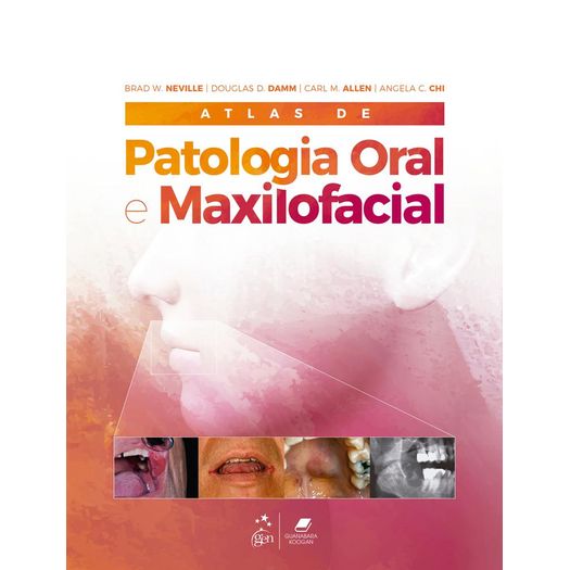 atlas de patologia oral e maxilofacial