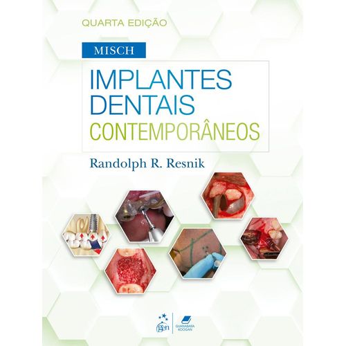 misch---implantes-dentais-contemporaneos