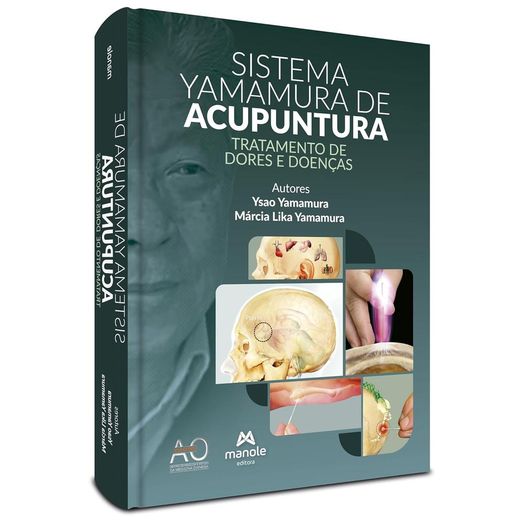 sistema yamamura de acupuntura sistema yamamura de acupuntura