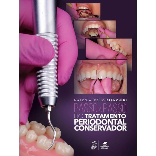 passo-a-passo-do-tratamento-periodontal-conservador passo-a-passo-do-tratamento-periodontal-conservador